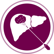 CABOMETYX Liver Ablation icon